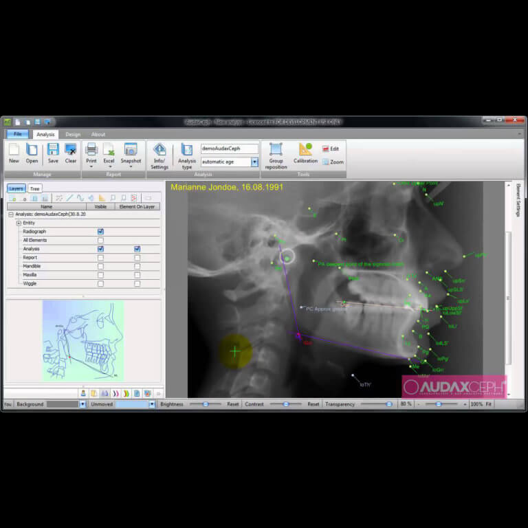 camosci-audaxceph-software-10