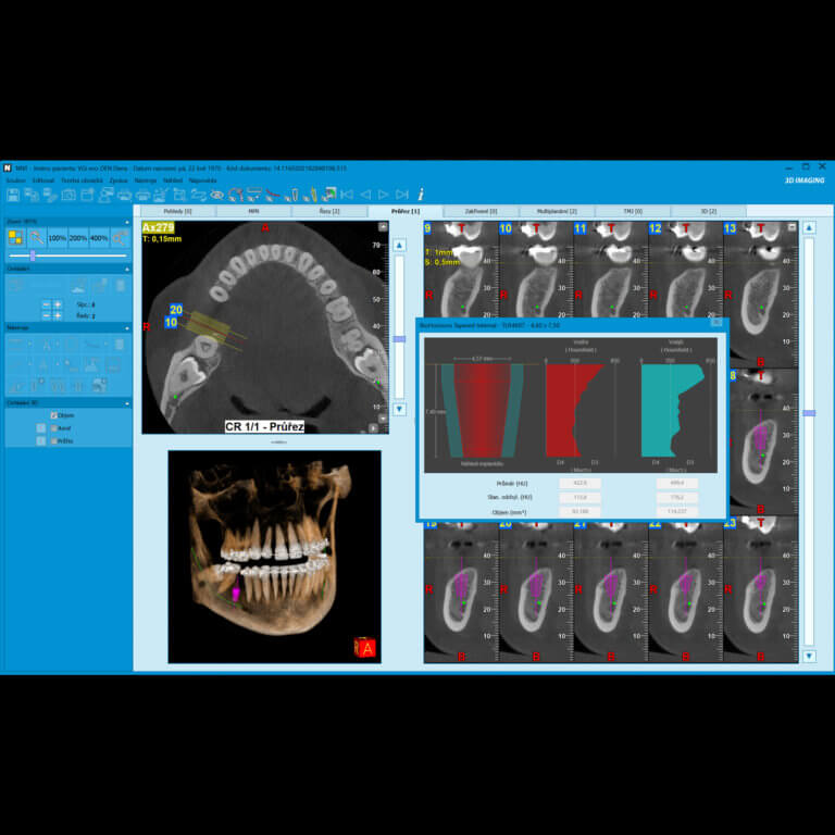 camosci-nnt-software-1