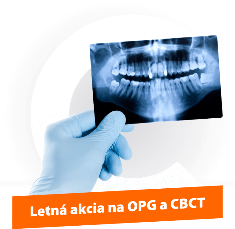 camosci-vyberte-si-premiove-opg-a-cbct-newtom-sk
