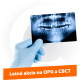 camosci-vyberte-si-premiove-opg-a-cbct-newtom-sk