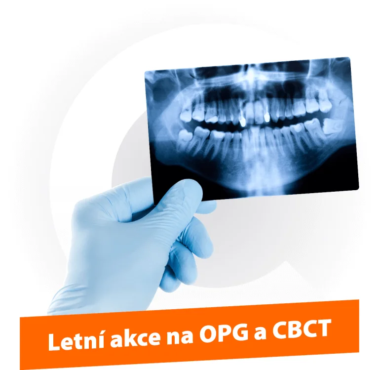 camosci-vyberte-si-premiove-opg-a-cbct-newtom